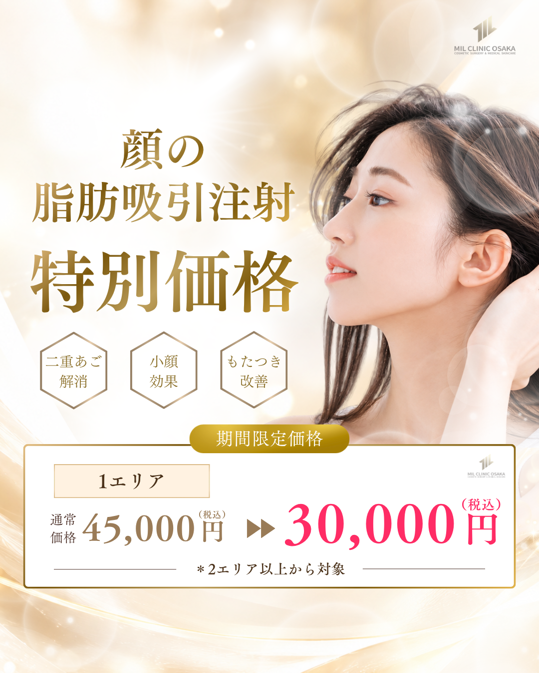 顔の脂肪吸引注射 2026年10月キャンペーン。料金・適用条件は本文をご確認ください。